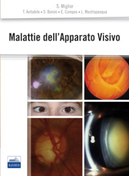 Malattie dell’Apparato Visivo