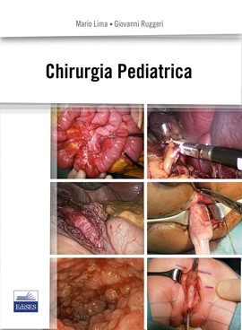 Chirurgia Pediatrica Chirurgia Pediatrica